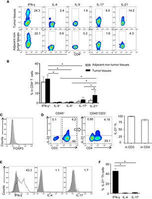 IL-21 Is an Accomplice of PD-L1 in the Induction of PD-1-Dependent Treg Generation in Head and Neck Cancer